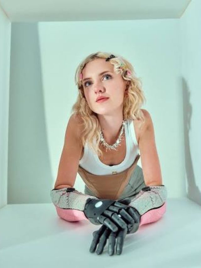 The Girl With 3D Printed Bionic Arms